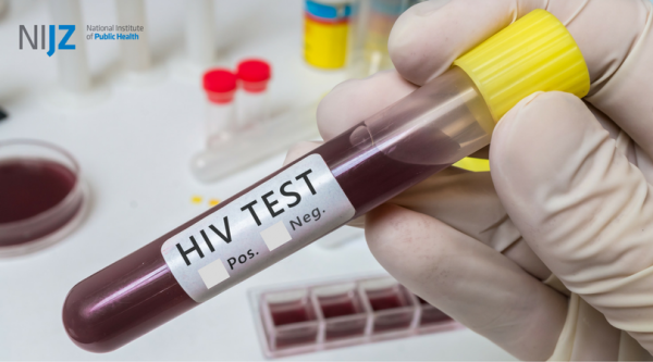 hiv-test